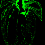 mutant heart x-ray